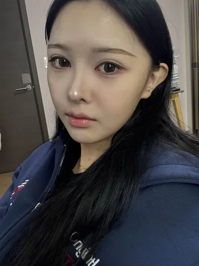 鼻の再手術をしたから、自撮りしがいがあります :)