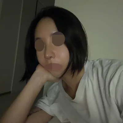 WANT美容外科のキム・ヒョヌ院長に鼻の再手術（自家肋軟骨）を受けたレビュー