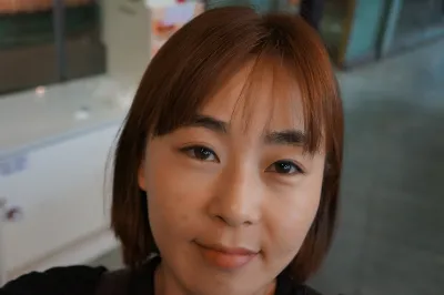 旦那が今のままでも綺麗だって手術に反対してたんだけど…