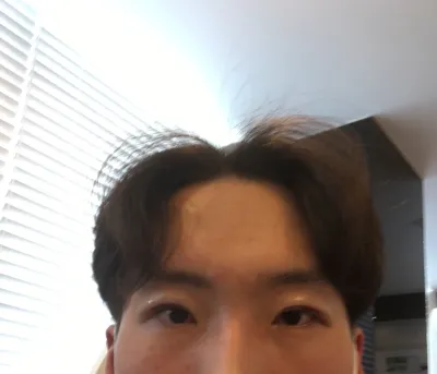 メンズ切開式目つき矯正レビューです。