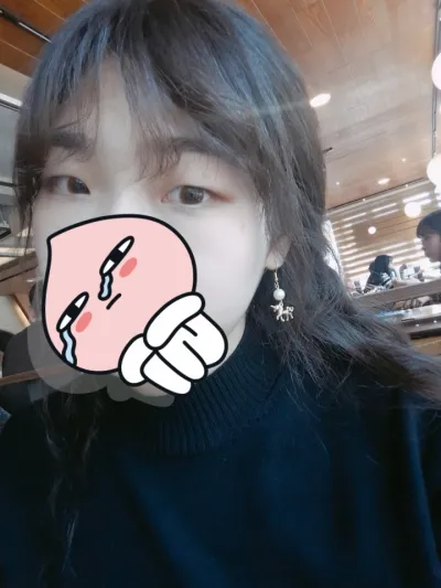 切開式目つき矯正+目尻切開手術 グッド!!!