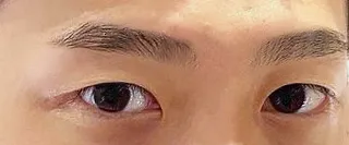 奥二重風の目つき矯正して1ヶ月