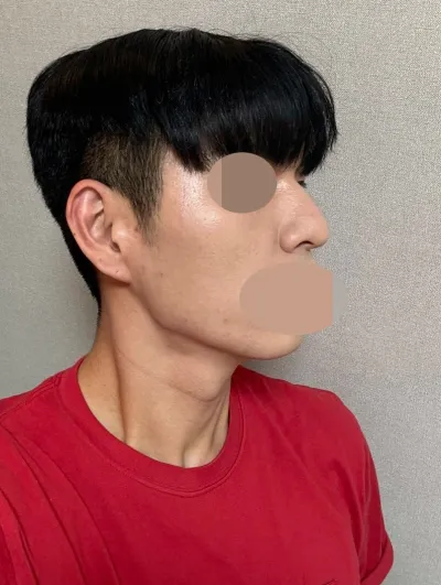 自然なので、みんなに聞かれます。