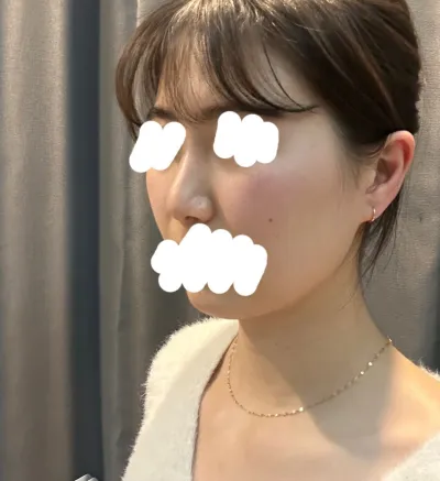 とても気に入っています。ベリーグッド整形外科、最高最高。