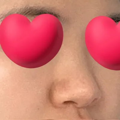 特に正面の改善がうまくいって、とても満足しています。