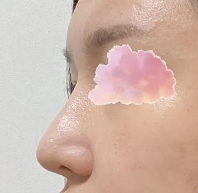 今まで整形してきた中で、こんなに親身になってくれた病院は初めてです。