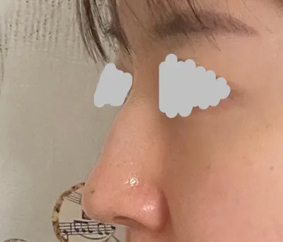 説明もとても丁寧にしてくださいましたし、手術もとてもうまくいって満足しています！