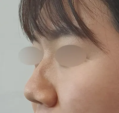 私の第二の父である金容佑院長、南載成院長！！！綺麗に手術してくださってありがとうございます！♥♥