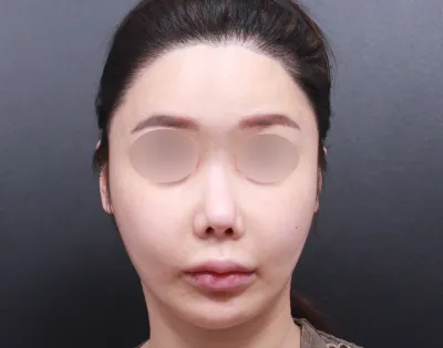 私は手術、ここだけで受けてます。院長先生方も責任感がありますし、スタッフの方々が本当に親切です。