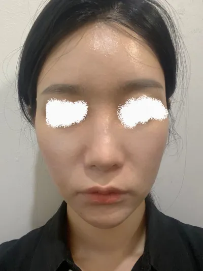 院長先生に昨年、長曲線エラ削りを受けて満足しているので、