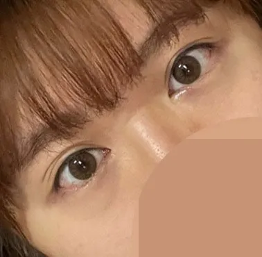 結果はめちゃくちゃ大満足！ 1