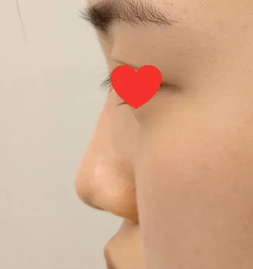 すごく気に入っていて、周りからも可愛いって大評判です。