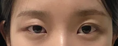 アイプチしなくなってから生活の質が変わりました。すごく満足してます>_<