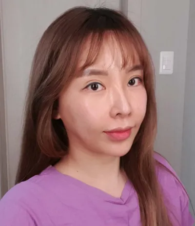 胸と二重顎の脂肪吸引、フルフェイス脂肪移植、リフティングをしました。