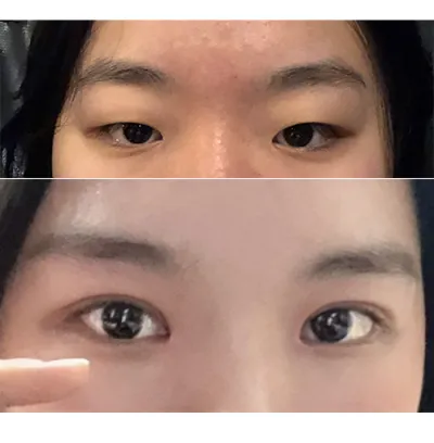 綺麗になったって言われるし、すごく満足です！！！