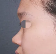 イム・ヨンミン院長、本当にありがとうございました。私と同じ悩みをお持ちの方に、ぜひおすすめしたいです！^^