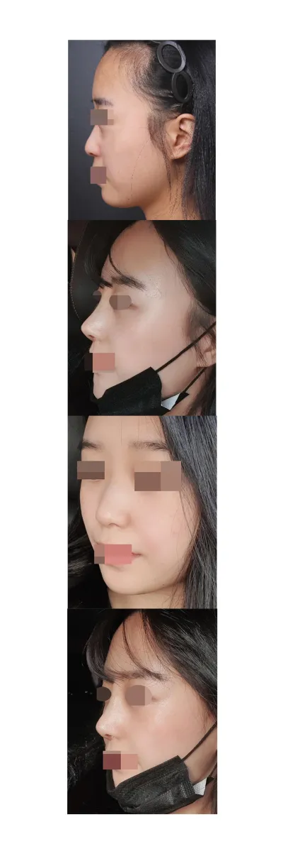 3週目のレビューです