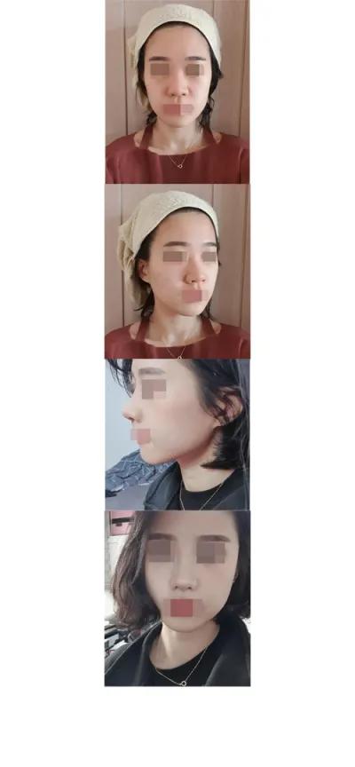 鼻が詰まって不便だったこと以外は、とても良かったです！