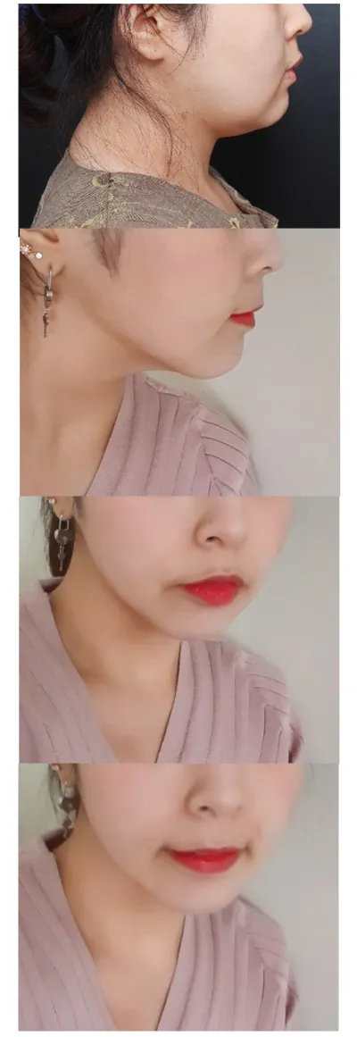 これからも頑張ってケアします！！院長先生、ありがとうございます！！