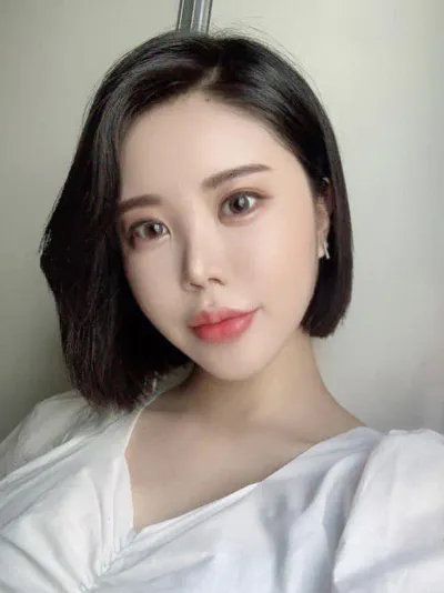 鼻の再手術、糸リフト、フルフェイス脂肪移植、二重顎の脂肪吸引を受けました〜