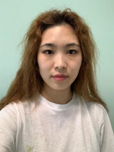 目・鼻・エラ削りレポいきます~~