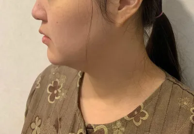 アフターケアも親切にしっかりしていただき、満足しています！！