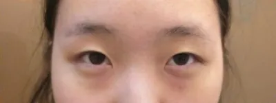 ベリーグッド整形外科のキム・ジュンヒョン院長に受けました。