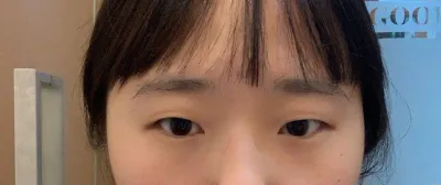 二重にして本当によかったですㅠㅠ