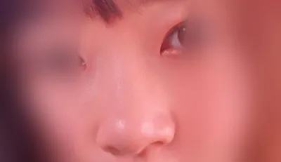 その他手術体験談