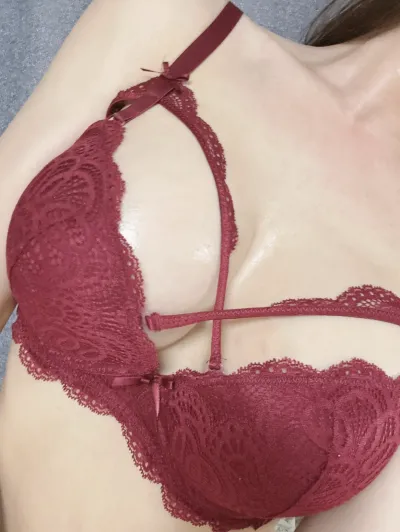 メロン美容外科 胸の再手術レビュー