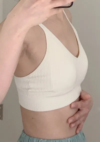 豊胸手術2ヶ月目レポ（モティバ / 355cc / アンダーバスト切開）