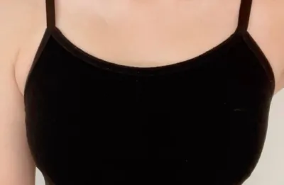 モティバ2ヶ月) たまに手術したことを忘れる時もあります。