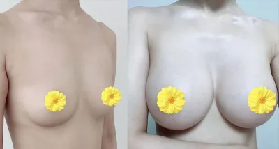 モティバ6ヶ月目) やっぱりメロンを選んで後悔はありません❤️