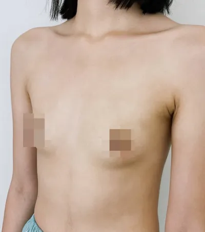 モティバ1ヶ月目) 1歳でも若いうちにするのがおすすめです！ (長文注意)