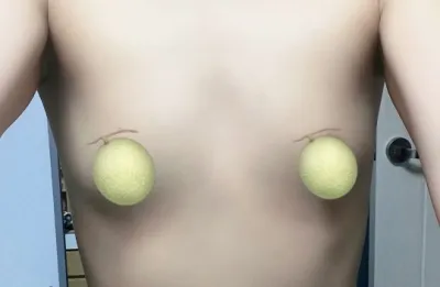 メンエク2ヶ月目) キム・ジュウォン院長、本当に神の手！！