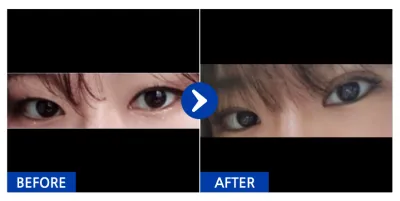 [カンナムオンニ] 自然癒着 / 1ヶ月目 / ニックネーム：ボラスゴン