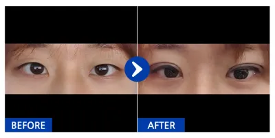 [カンナムオンニ] 自然癒着 / 1ヶ月目 / ニックネーム：ㅋㄱㅋㅋㄲ