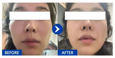 [カンナムオンニ] 頬骨 / 1ヶ月目 / ニックネーム：ミニングメイド