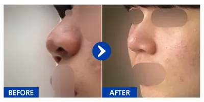 [カンナムオンニ] 鼻 / 1ヶ月目 / ニックネーム：イ・ガオン12