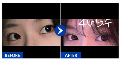 [カンナムオンニ] 自然癒着 / 1ヶ月目 / ニックネーム：ミントチョコタピオカ