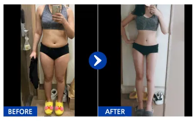 [カンナムオンニ] 全身脂肪吸引 / 3ヶ月目 / ニックネーム：わたあめモグ