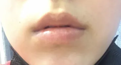 [プチ] ムンチチャウルン - フィラー