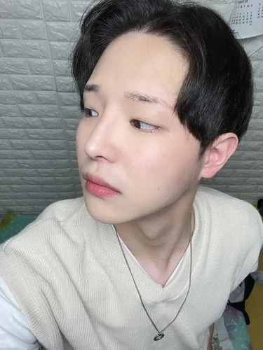 [男性] ヒョクさん - 切開式眼瞼下垂矯正、目頭切開、鼻