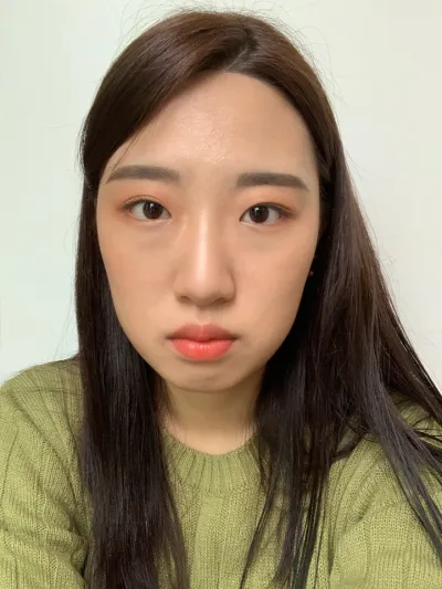 [目] シャララ - 非切開式眼瞼下垂矯正、目頭切開、目の下の脂肪再配置