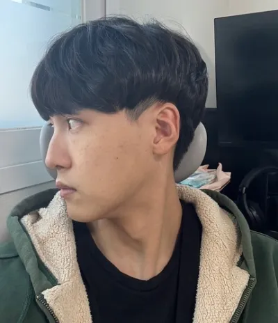 [男性] 븽븽 - 切開式眼瞼下垂手術、鼻、輪郭3種