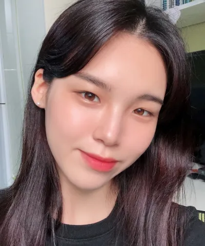 [目] カンヘ - 埋没法二重手術（再手術）