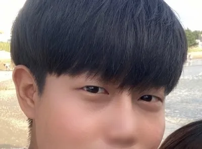 [男性] ユーガン - 切開式眼瞼下垂手術