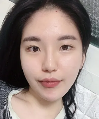 [目] サンダルギ - 目頭切開