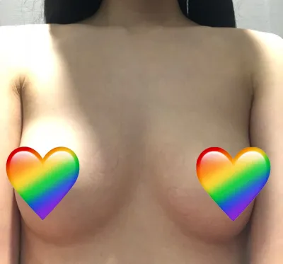 [豊胸] 感謝 - 胸