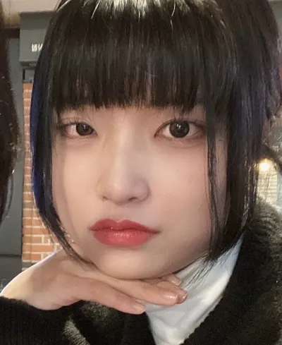 [目] チャンニョン - 切開式眼瞼下垂修正手術